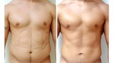 Best Cosmetic Surgeon in Delhi NCR, New Delhi