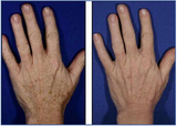 Best Cosmetic Surgeon in Delhi NCR, New Delhi