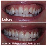 Smilelign Limited, Woodseats Close