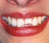 Richard Wilson D.D.S. Emergency Dentist, Richard Wilson D.D.S. Emergency Dentist, Doylestown,