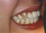 Richard Wilson D.D.S. Emergency Dentist, Richard Wilson D.D.S. Emergency Dentist, Doylestown,