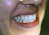 Richard Wilson D.D.S. Emergency Dentist, Richard Wilson D.D.S. Emergency Dentist, Doylestown,