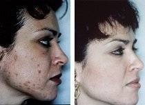  Profile Photos of Microdermabrasion London 2 Harley Street - Photo 1 of 1