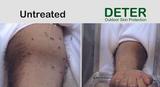  Deter Outdoor Skin Protection 6276 San Ignacio Avenue, Ste A 