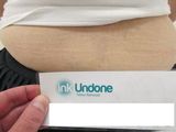 Melbourne Laser Clinic | ink undone, Melbourne