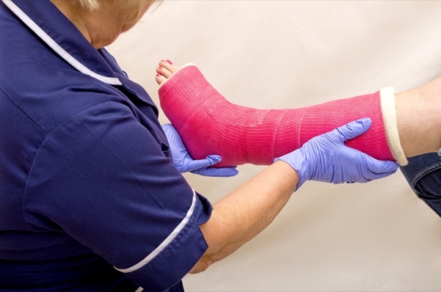 Ladies leg in Cast being treated by a Nurse Miami Injury Lawyer of Miami Injury Lawyer 5200 Blue Lagoon Dr #292 - Photo 6 of 9