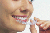 Diamond Braces, Edison