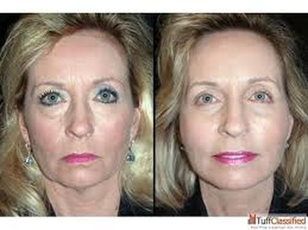  Profile Photos of Best Cosmetic Surgeon Delhi 302, Agarwal Chamber, Veer Savarkar Block Shakarpur New Delhi-110092 - Photo 2 of 3