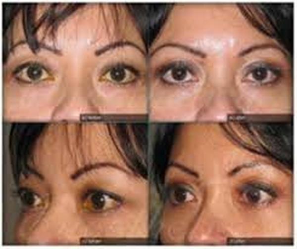  Profile Photos of Best Cosmetic Surgeon Delhi 302, Agarwal Chamber, Veer Savarkar Block Shakarpur New Delhi-110092 - Photo 3 of 3