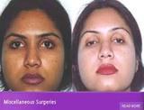 Best Cosmetic Surgeon Delhi, Delhi