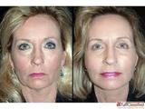 Best Cosmetic Surgeon Delhi, Delhi