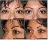 Best Cosmetic Surgeon Delhi, Delhi