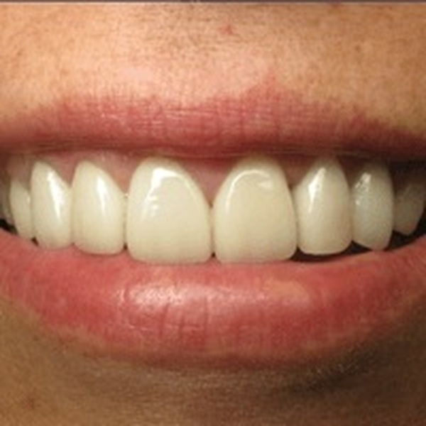  Pricelists of Avatar Dental Care 545 E. Market Street, Suite G - Photo 1 of 2