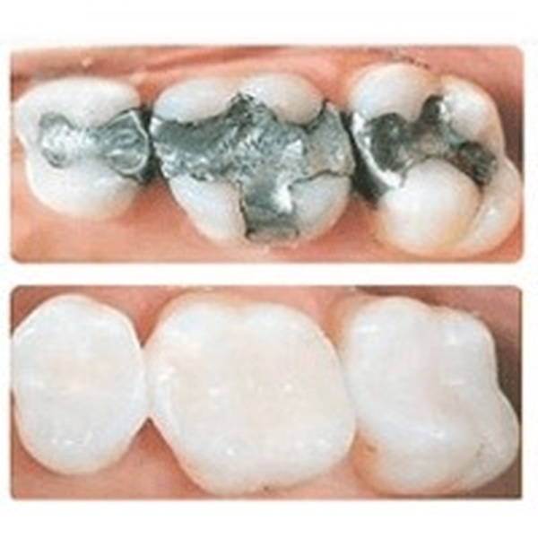  Pricelists of Avatar Dental Care 545 E. Market Street, Suite G - Photo 2 of 2