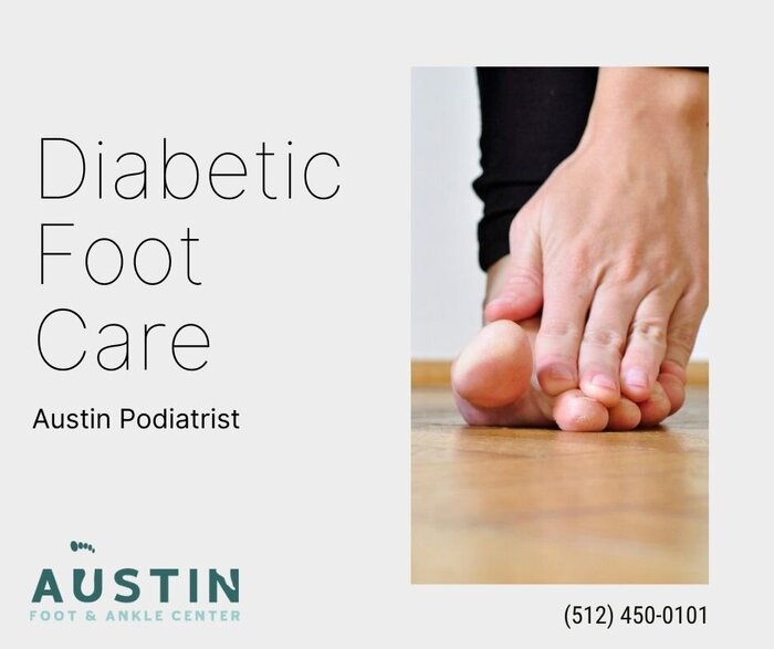 Foot care is particularly important if you have diabetes. Foot complications are a common problem of this condition. See to it that you ask your Austin podiatrist to examine your feet regularly for any evidence of nerve damage or poor circulation. https:/ New Album of Austin Foot & Ankle Center 9012 Research Blvd #C13 - Photo 16 of 18 Foot care is particularly important if you have diabetes. Foot complications are a common problem of this condition. See to it that you ask your Austin podiatrist to examine your feet regularly for any evidence of nerve damage or poor circulation. https:/ New Album of Austin Foot & Ankle Center 9012 Research Blvd #C13 - Photo 16 of 18
