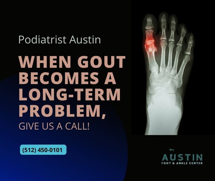  New Album of Austin Foot & Ankle Center 9012 Research Blvd #C13 - Photo 9 of 18