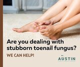 

Toenail fungus is a common infection on the nail, and it can be challenging to get rid of. You might suffer from toenail fungus if you have noticed yellowish, thickened, brittle, crumbly, or ragged nails. 
https://www.facebook.com/austinfootandanklec, Austin Foot & Ankle Center, Austin