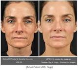 Hair Transplant Doctors in Delhi, Delhi