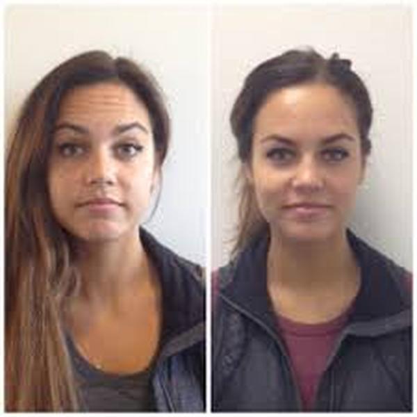 Profile Photos of Botox Cost 37 Pocket-1  Jasola Nr Apollo Hospital New Delhi-110025 - Photo 1 of 3