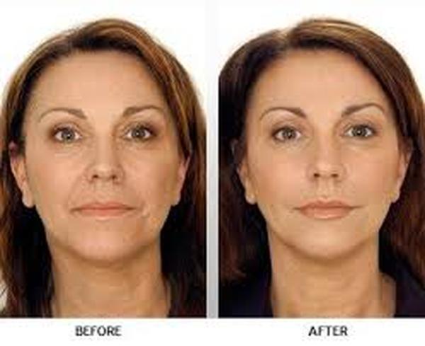  Profile Photos of Botox Cost 37 Pocket-1  Jasola Nr Apollo Hospital New Delhi-110025 - Photo 3 of 3