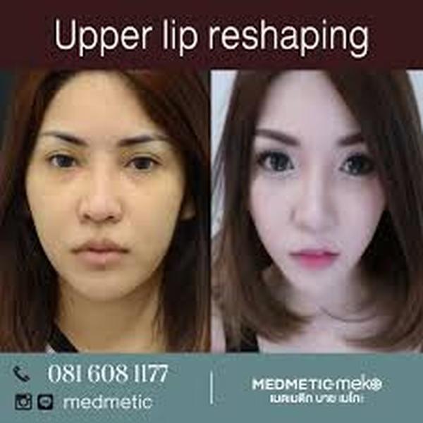  Profile Photos of Lips Reshaping 37 Pocket-1  Jasola Nr Apollo Hospital New Delhi-110025 - Photo 1 of 4