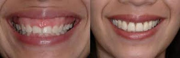  Profile Photos of Lips Reshaping 37 Pocket-1  Jasola Nr Apollo Hospital New Delhi-110025 - Photo 2 of 4