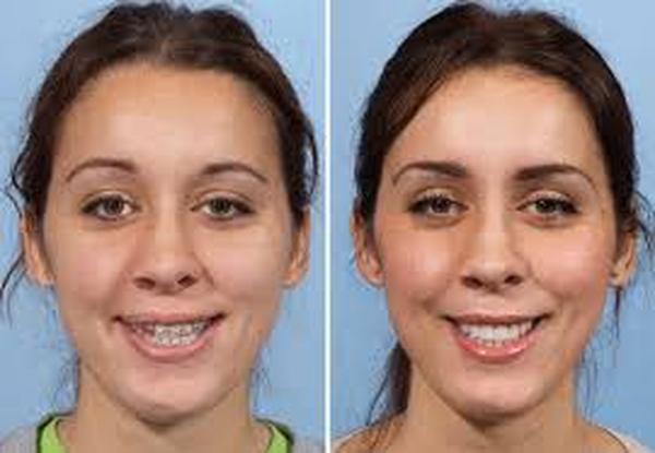  Profile Photos of Lips Reshaping 37 Pocket-1  Jasola Nr Apollo Hospital New Delhi-110025 - Photo 4 of 4