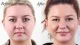 Lips Reshaping, Delih