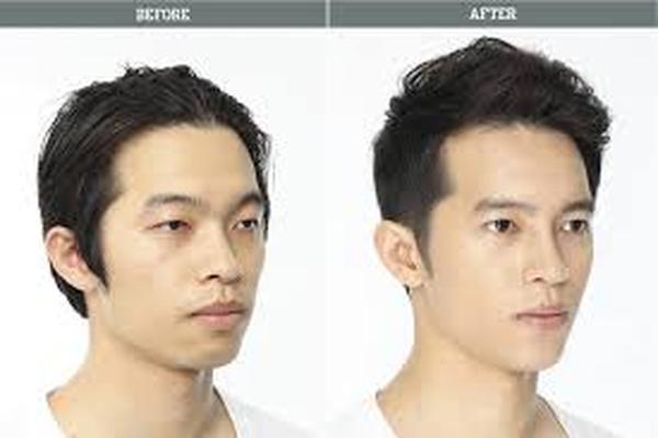  Profile Photos of Cosmetic Surgery For Men Face 37 Pocket-1  Jasola Nr Apollo Hospital New Delhi-110025 - Photo 2 of 5