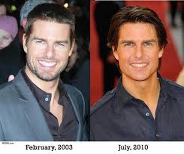  Profile Photos of Cosmetic Surgery For Men Face 37 Pocket-1  Jasola Nr Apollo Hospital New Delhi-110025 - Photo 3 of 5