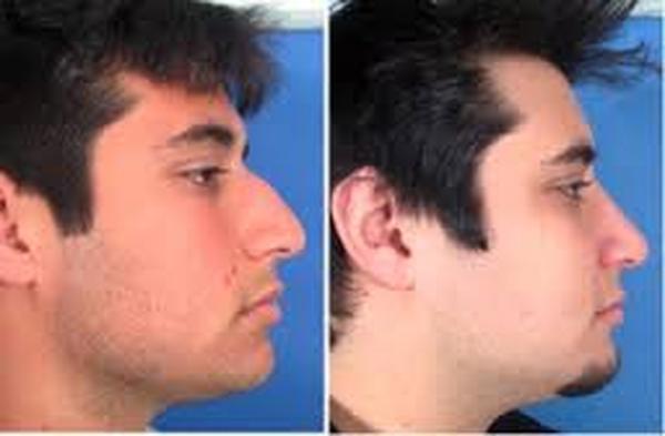  Profile Photos of Cosmetic Surgery For Men Face 37 Pocket-1  Jasola Nr Apollo Hospital New Delhi-110025 - Photo 5 of 5