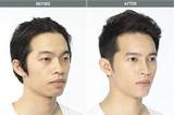 Cosmetic Surgery For Men Face, Delhi
