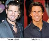 Cosmetic Surgery For Men Face, Delhi