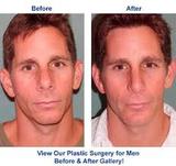 Cosmetic Surgery For Men Face, Delhi