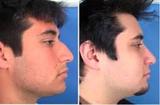 Cosmetic Surgery For Men Face, Delhi