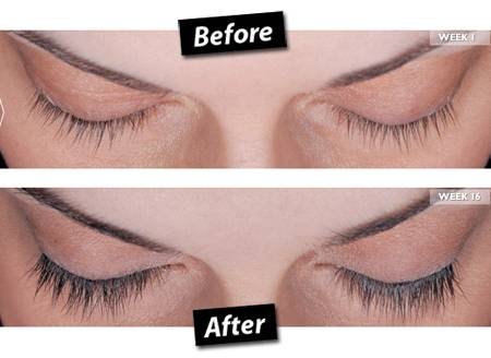Latisse CLCI Procedures of Cosmetic Laser Center of Irvine 15775 Laguna Canyon Rd. Suite 270 - Photo 6 of 17