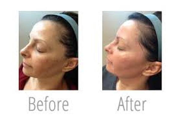  Profile Photos of Pigmentation Removal 37 Pocket-1  Jasola Nr Apollo Hospital New Delhi-110025 - Photo 1 of 4