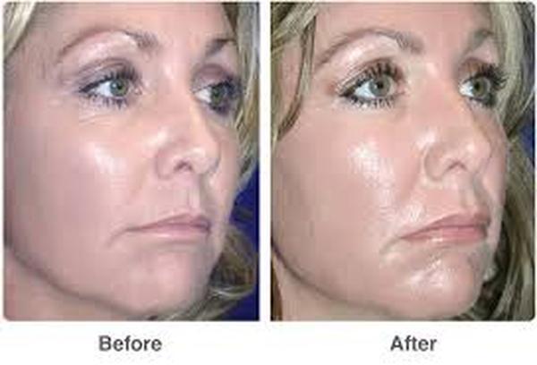  Profile Photos of Pigmentation Removal 37 Pocket-1  Jasola Nr Apollo Hospital New Delhi-110025 - Photo 2 of 4