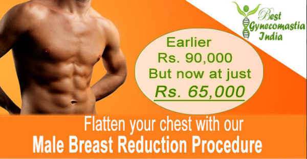  Pricelists of Best  Gynecomastia Surgery in India 13 A Palam Marg, Vasant Vihar - Photo 1 of 1