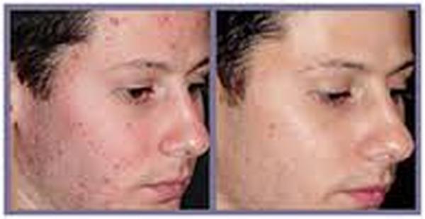  Profile Photos of Face Plastic Surgery Cost in Delhi 302, Agarwal Chamber, Veer Savarkar Block Shakarpur New Delhi-110092 - Photo 1 of 3