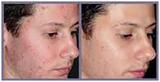 Face Plastic Surgery Cost in Delhi, Delhi