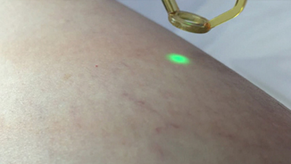 HairFree Laser Center Profile Photos of HairFree Laser Center 16661 Ventura Blvd., Suite 409 - Photo 10 of 10
