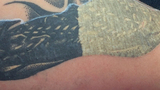 HairFree Laser Center, HairFree Laser Center, Encino