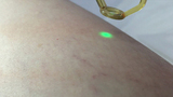 HairFree Laser Center, HairFree Laser Center, Encino