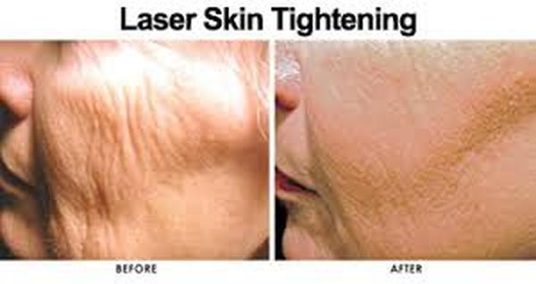  Pricelists of Skin tightening treatment 37 Pocket-1  Jasola Nr Apollo Hospital New Delhi-110025 - Photo 2 of 3