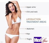 Liposuction Surgery, New Delhi