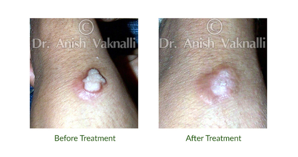  Profile Photos of Homeo Consult R&D Jain Chambers, S.V. Road, Bandra West - Photo 2 of 3