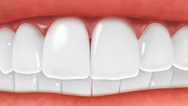  Profile Photos of Cosmetic Dentist Brooklyn 236 86th St - Photo 3 of 4