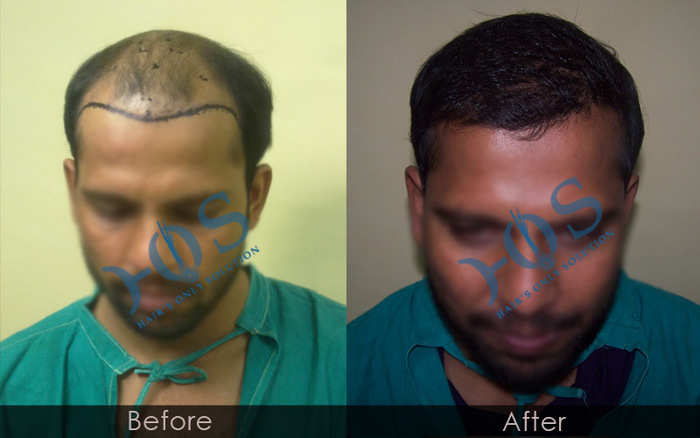 New Album of Hos Hair Clinic A-757, Tulsi Marg, Sec 19 - Photo 2 of 9