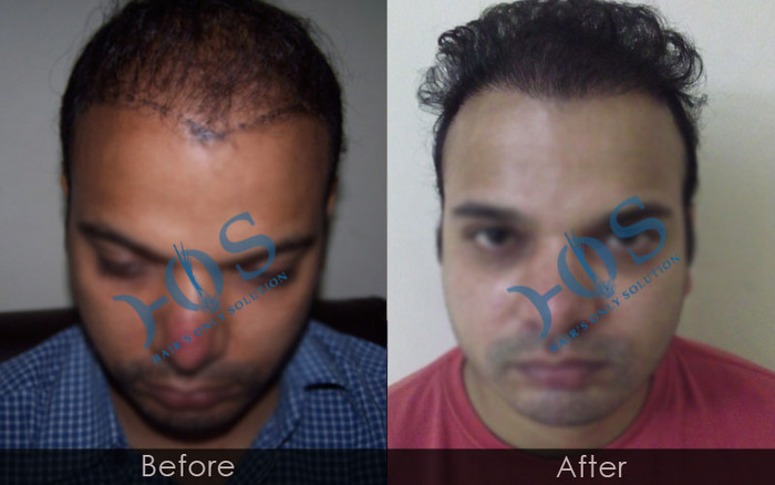 New Album of Hos Hair Clinic A-757, Tulsi Marg, Sec 19 - Photo 7 of 9
